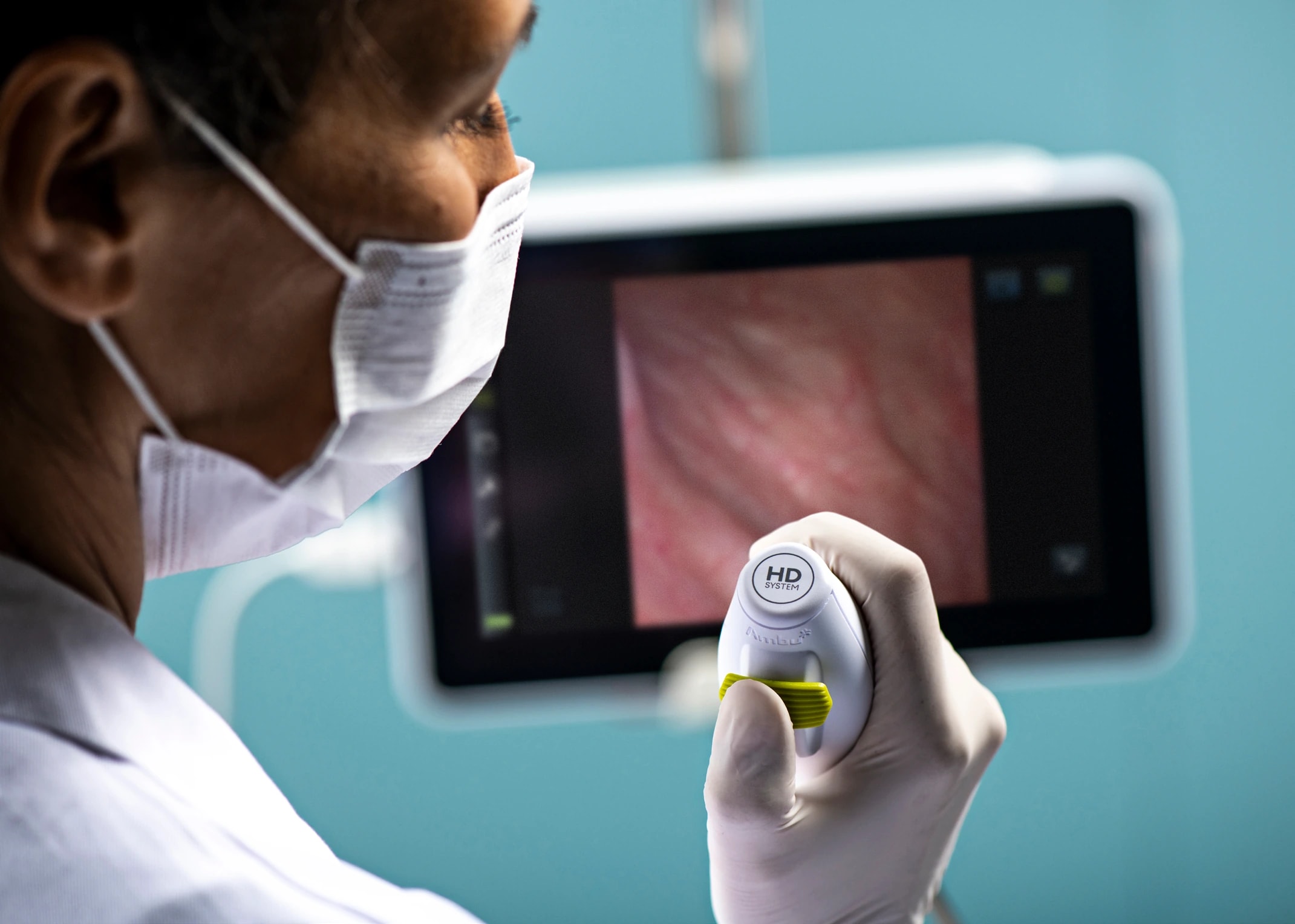 Un profesional sanitario con mascarilla sostiene un cistoscopio Ambu junto a un monitor de endoscopia.